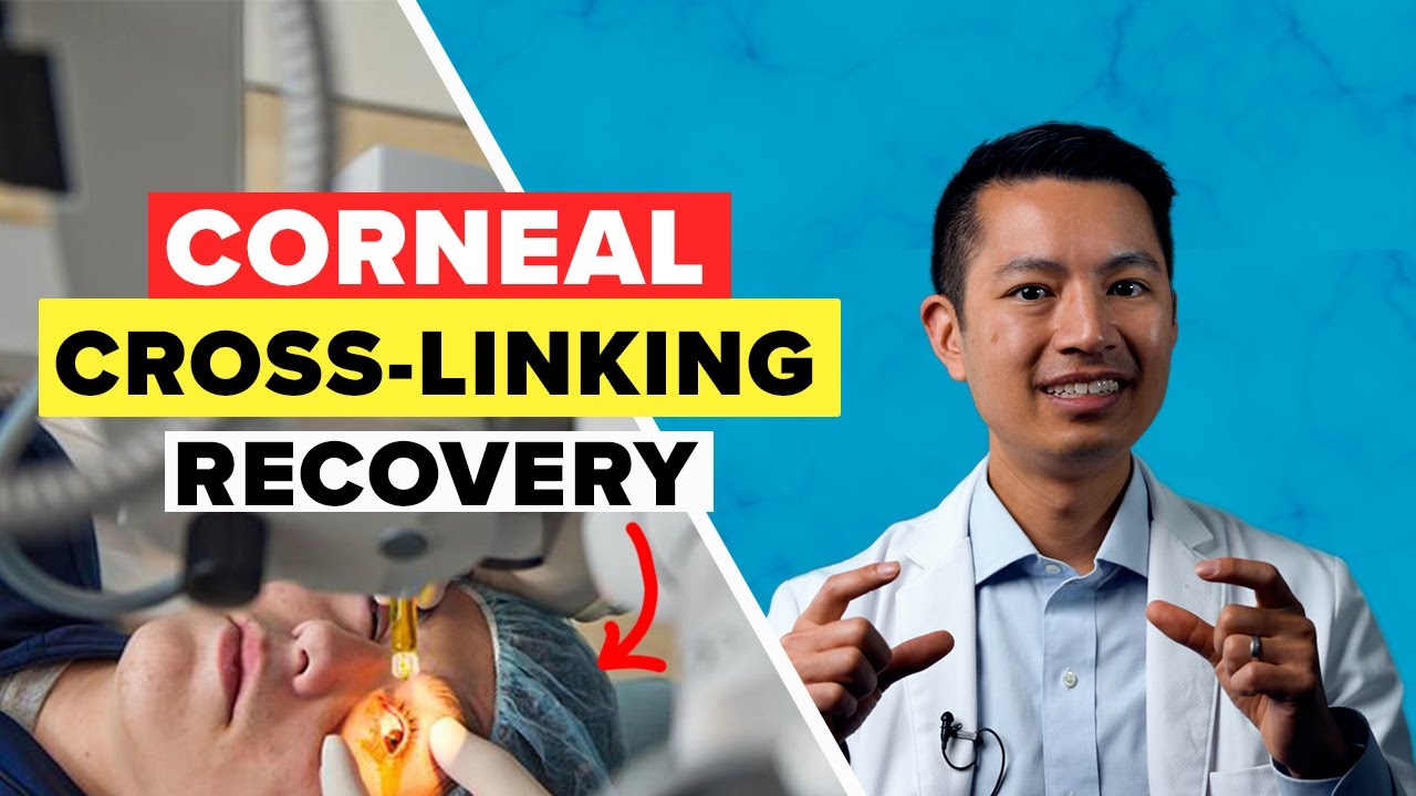 What to Expect During Your Corneal Cross-Linking Surgery?
