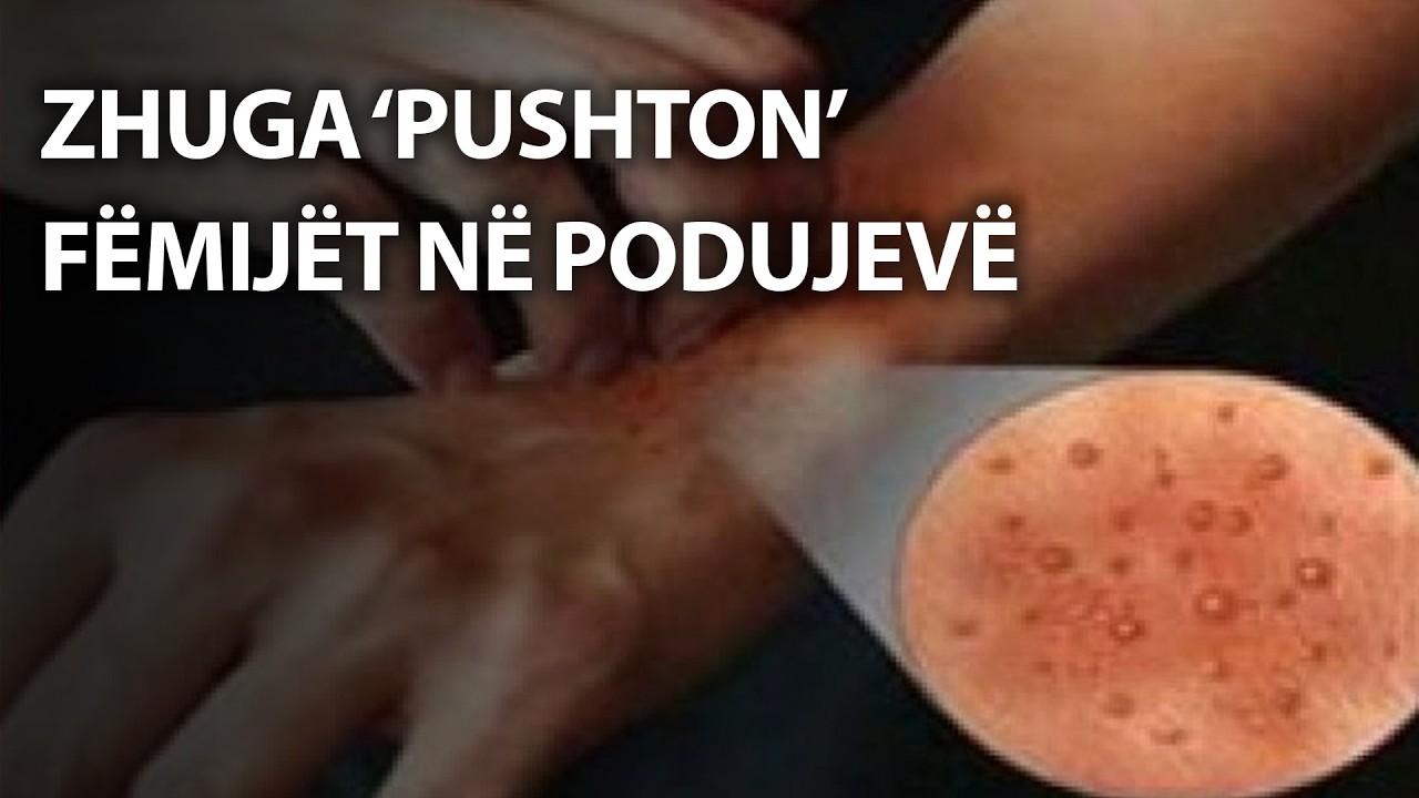 ZHUGA ‘pushton’ fëmijët në Podujevë/ “Nga mungesa e ujit…” – Ora 7