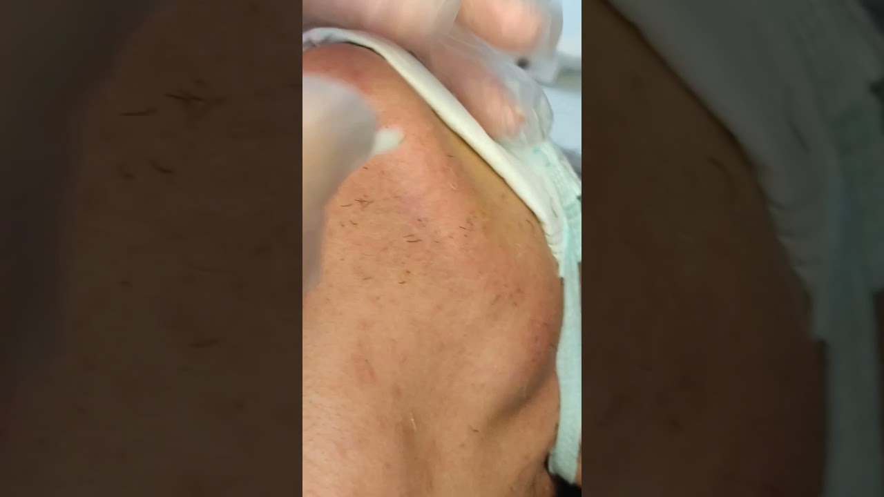 Electrolysis insertion classes İğneli Epilasyon Amerikan Güzellik Salonu Gaziantep Tel:05539578735