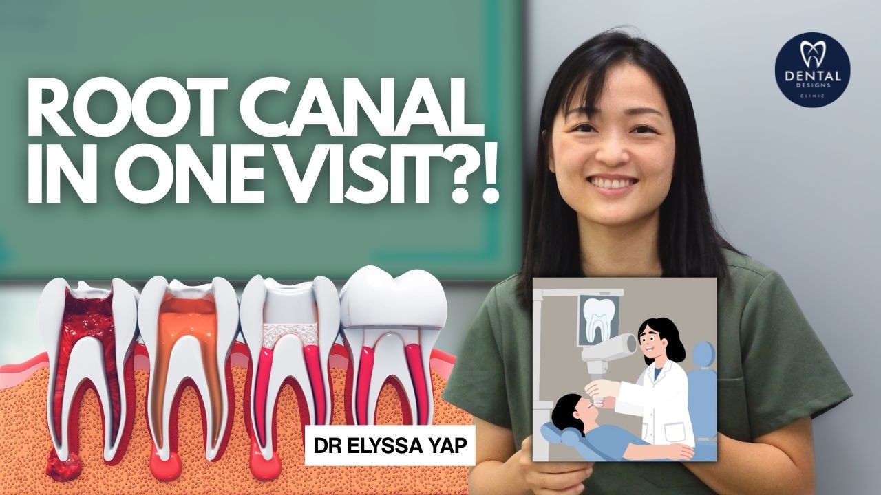 Root Canal in One Appointment? Here's When It's Possible!