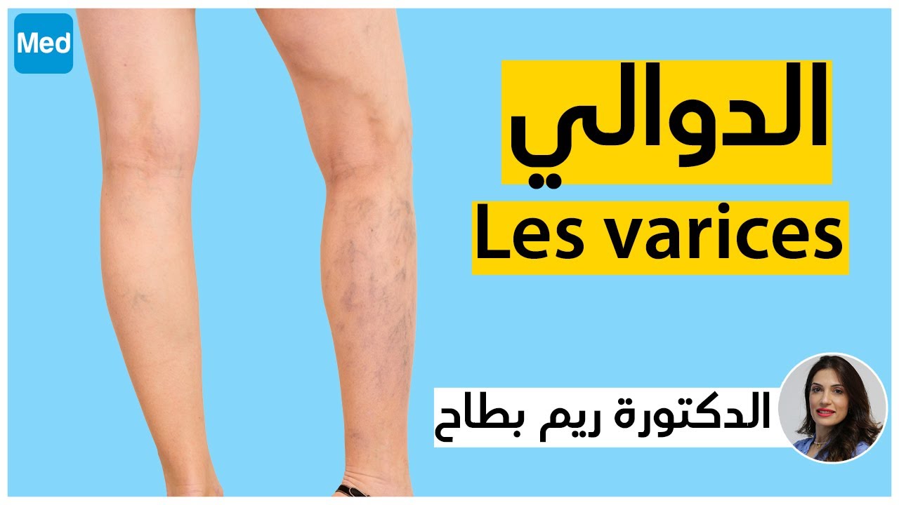 الدوالي | الدكتورة ريم بطاح بن يدّر