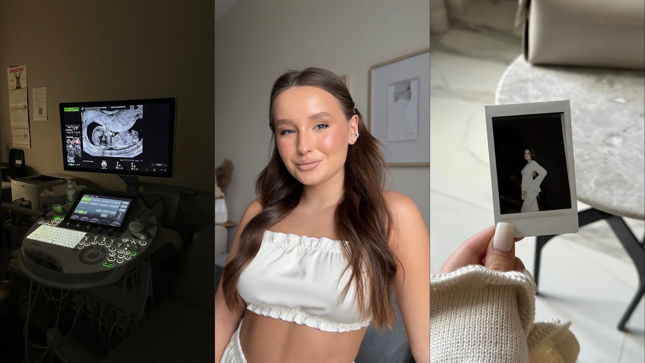 VLOG первого триместра🍼