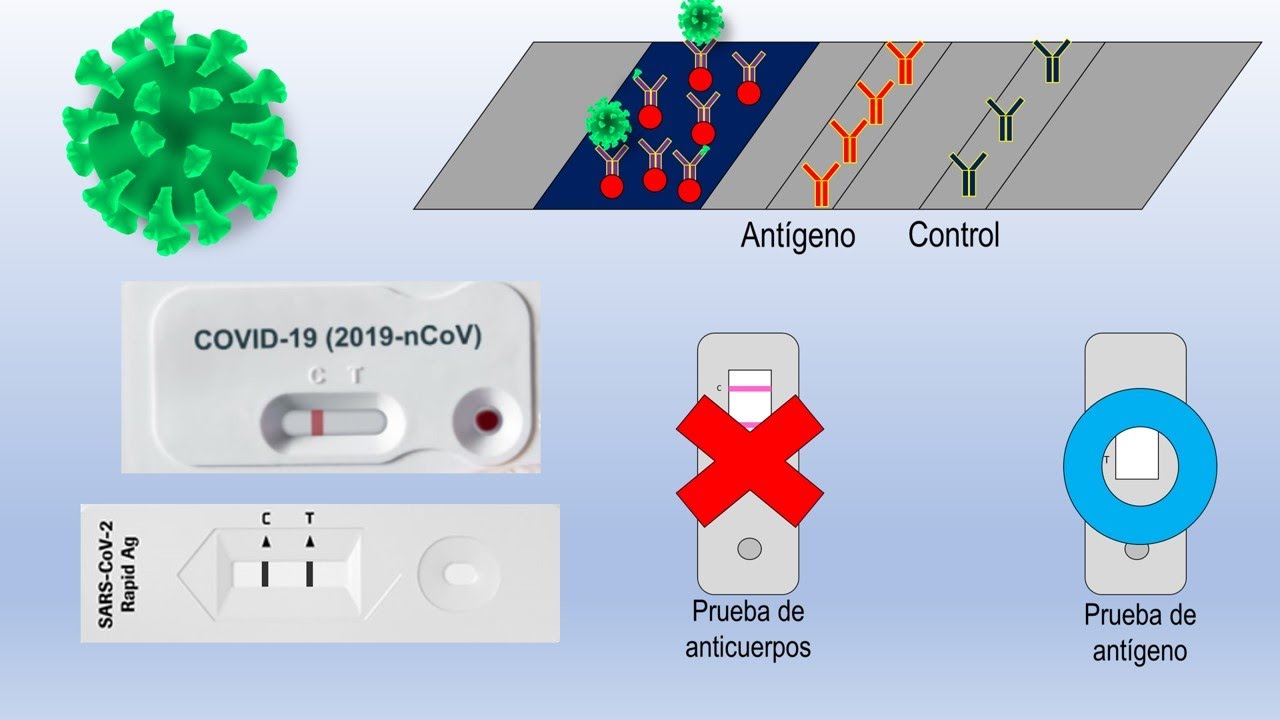 Pruebas de ant&iacute;genos para SARS-CoV-2 | C&oacute;mo funcionan y c&oacute;mo interpretarlas