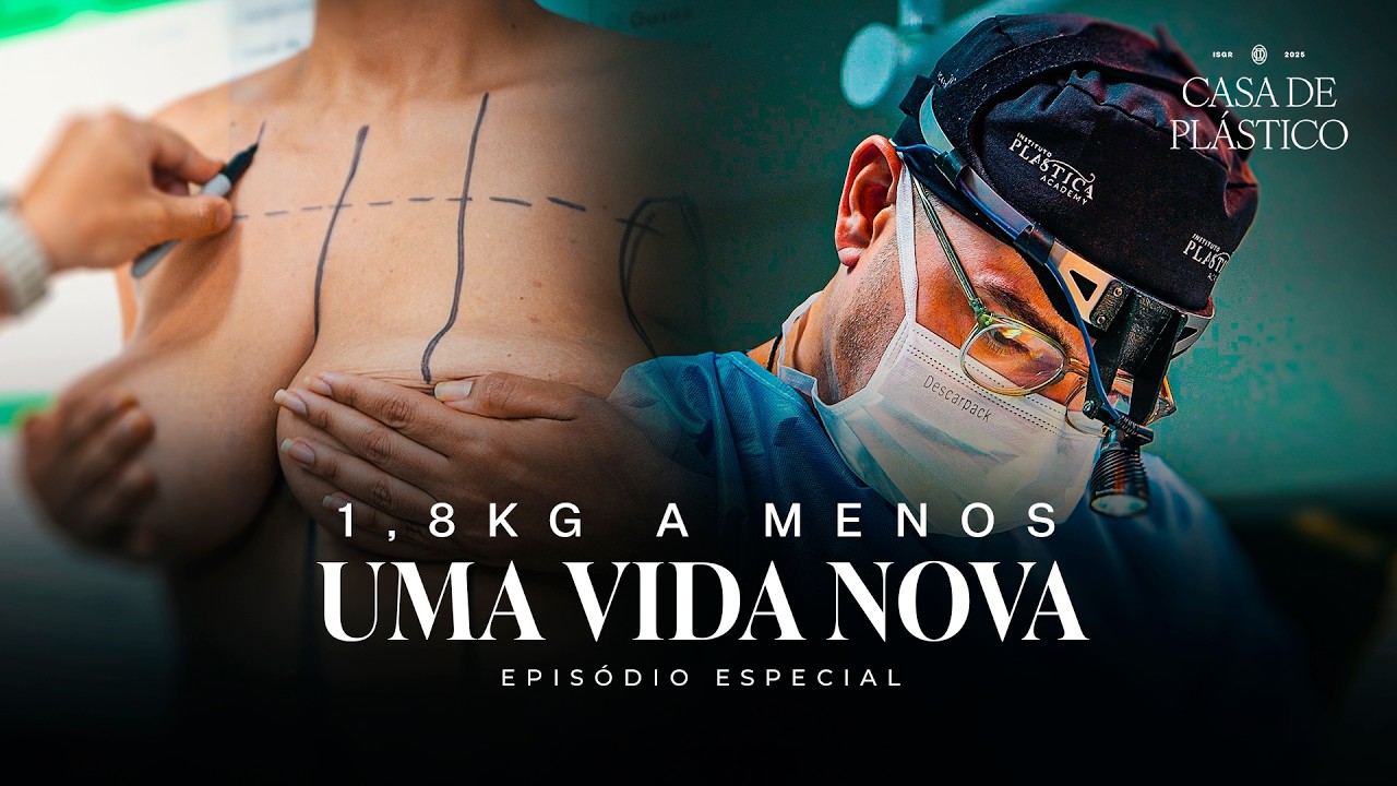 Casa de Plástico: Mamoplastia Redutora — O Final de Uma Dor, o Início de Uma Nova Vida | Dr Ícaro