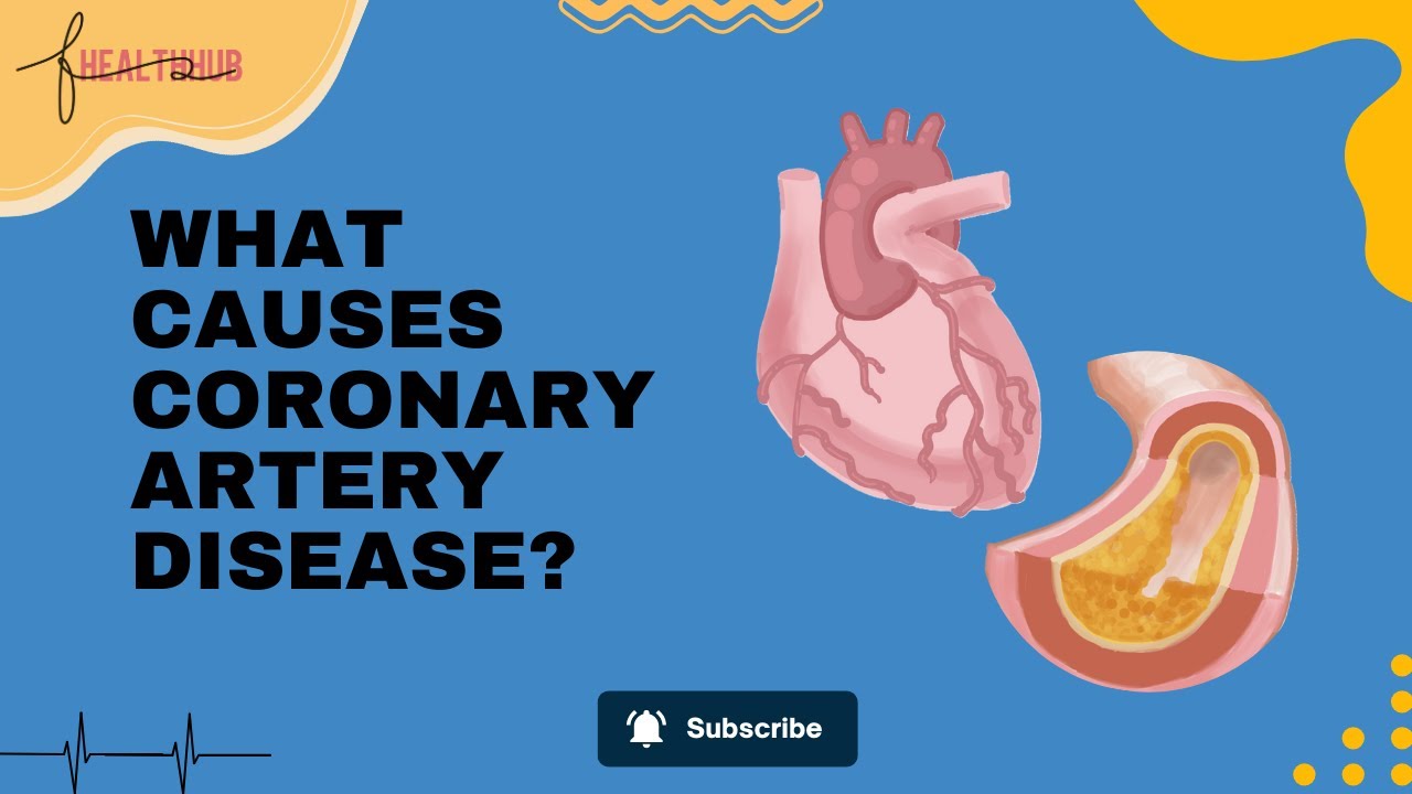 Coronary Artery Disease Explained: Signs, Risks & How to Prevent a Heart Attack