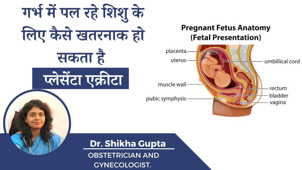 प्लेसेंटा एक्रीटा क्या है और क्या हैं इसके कारण, लक्षण और उपचार Placenta Accreta by Dr. Shikha Gupta