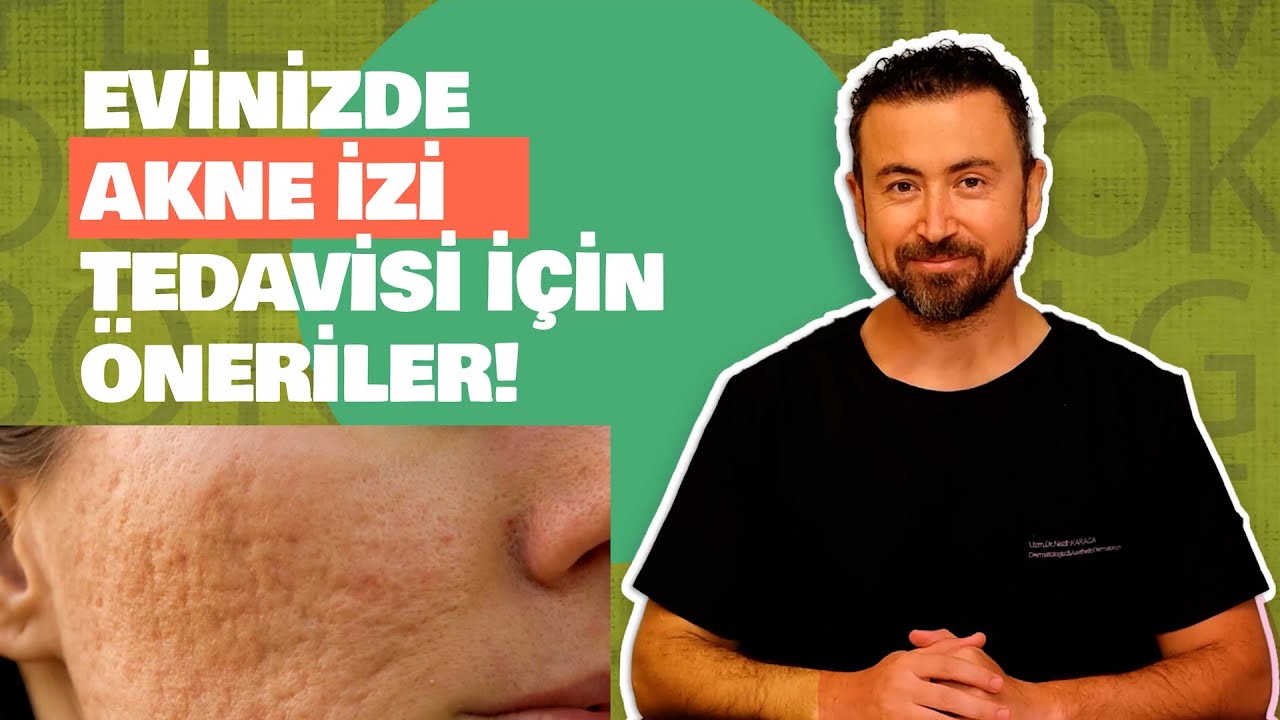 Evde akne izi (Skar) tedavisi mümkün mü?