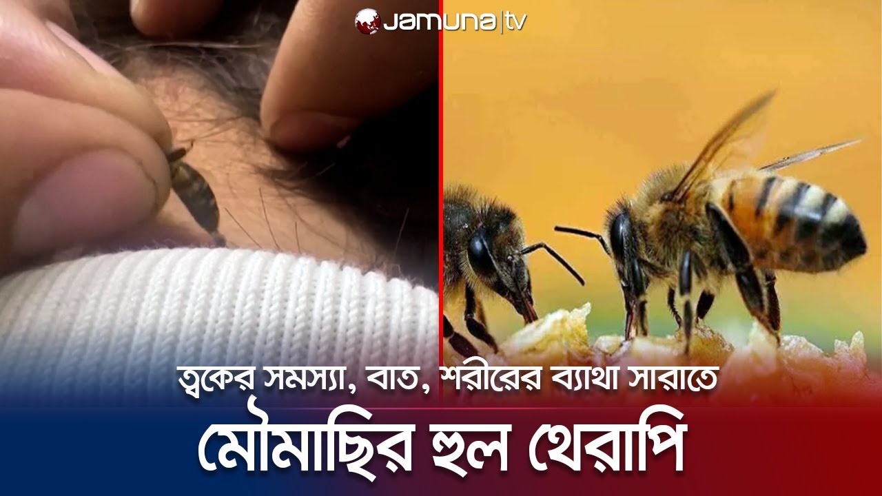 মৌমাছির হুল ফুটিয়ে চিকিৎসা; জনপ্রিয় হয়ে উঠেছে সিরিয়ায় | Syria Bee Medicine