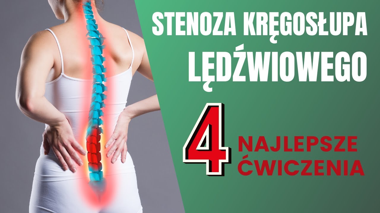 Stenoza kanału kręgowego w odcinku lędźwiowym &ndash; ćwiczenia