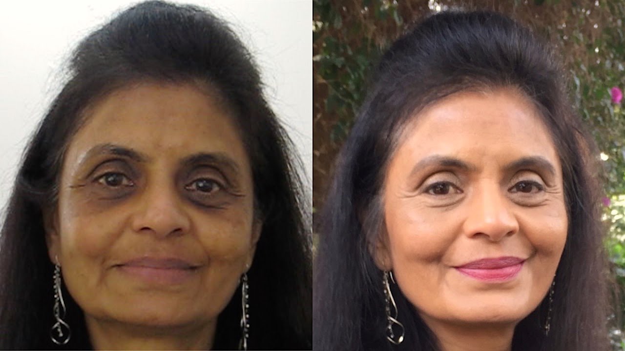 How to Cover Dark Circles & Hyperpigmentation | Indian, Tan Skin