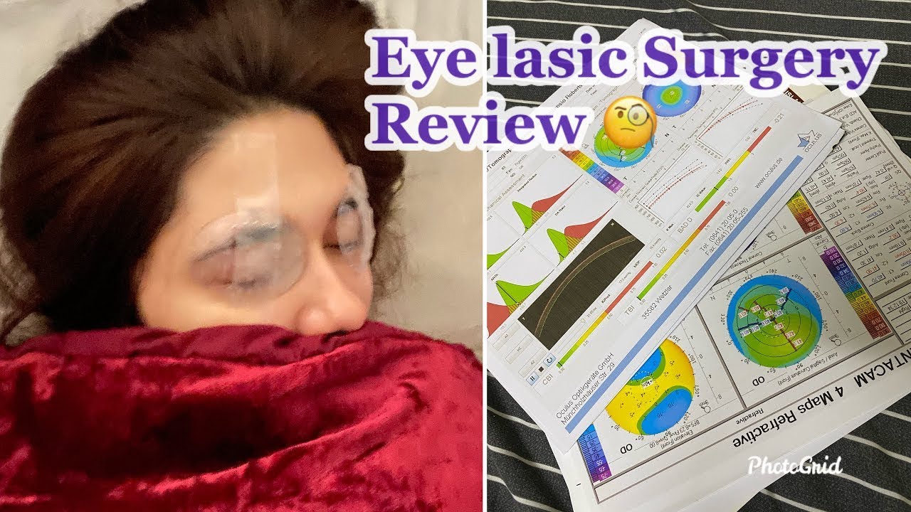 Коррекция зрения методом Lasik — честный отзыв и мой опыт!!!