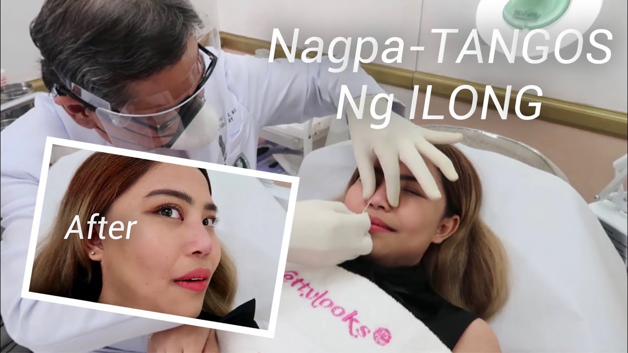 My NOSE Fillers Experience 💉 (Plus Nagpa-Covid RAPID TEST Ako!)