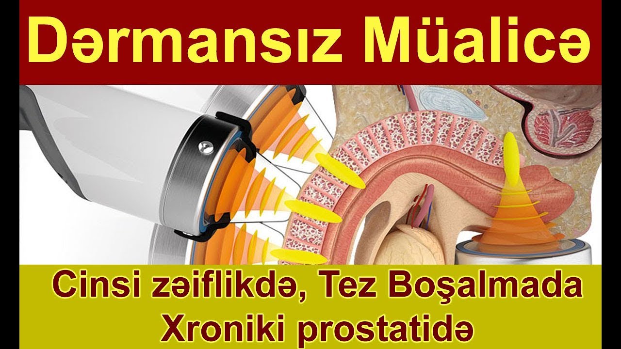 Dərmansız müalicə (Cinsi zəiflikdə, Erkən eyakuyasiyada, xroniki prostatitdə)  yeni