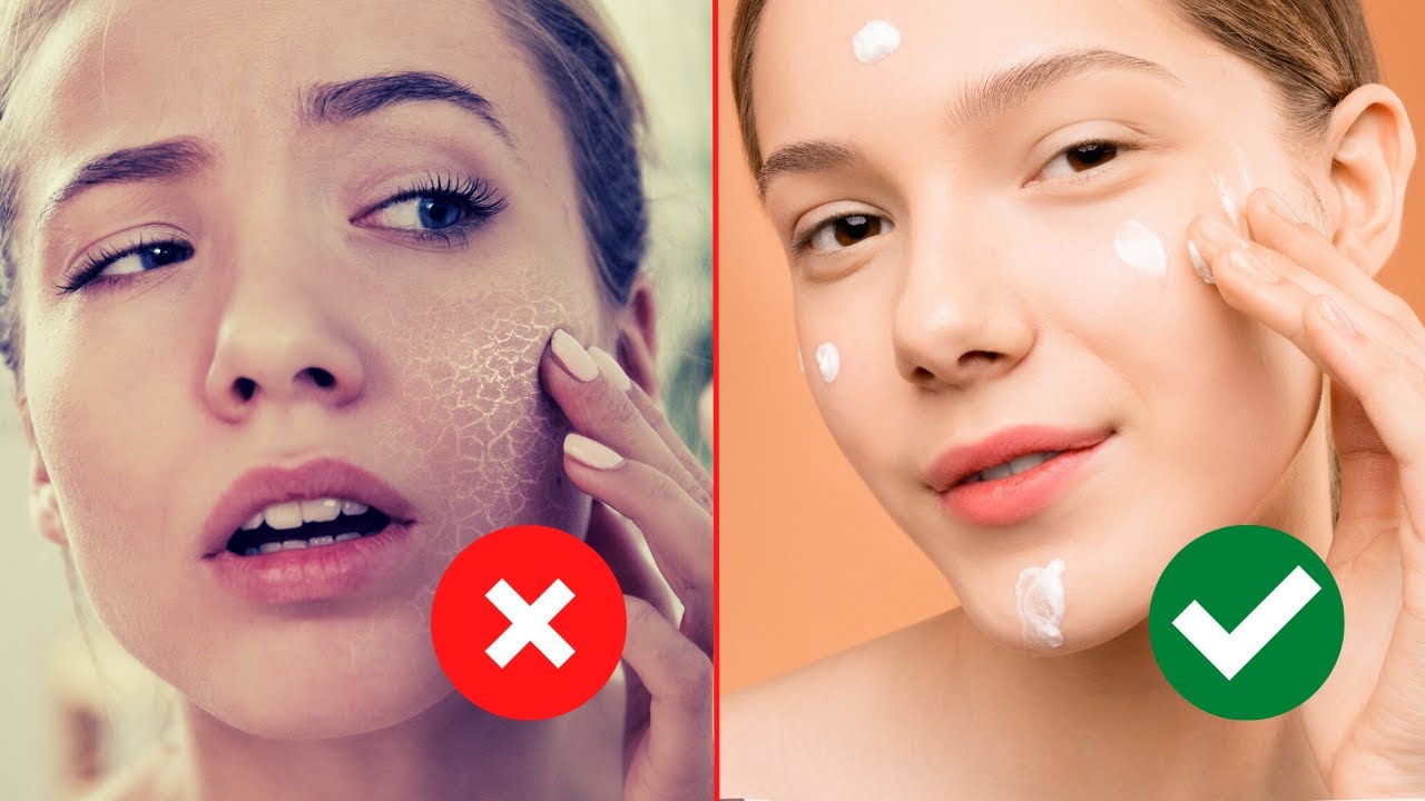 4 Cách trị khô da mặt tại nhà vào mùa đông - Bác sĩ Nguyên