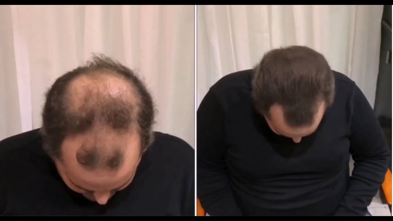 Hair Fiber Spray of Hair Cubed