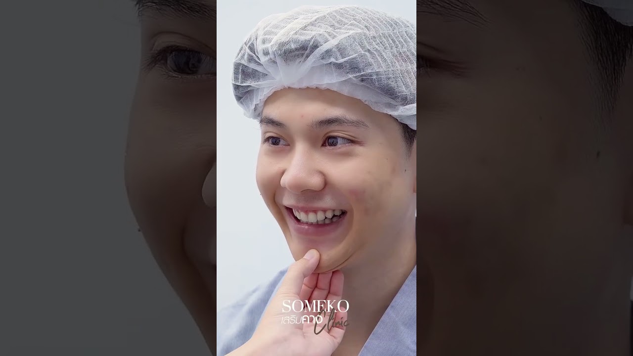 คางตัดคางบุ๋ม #เสริมคาง #someko
