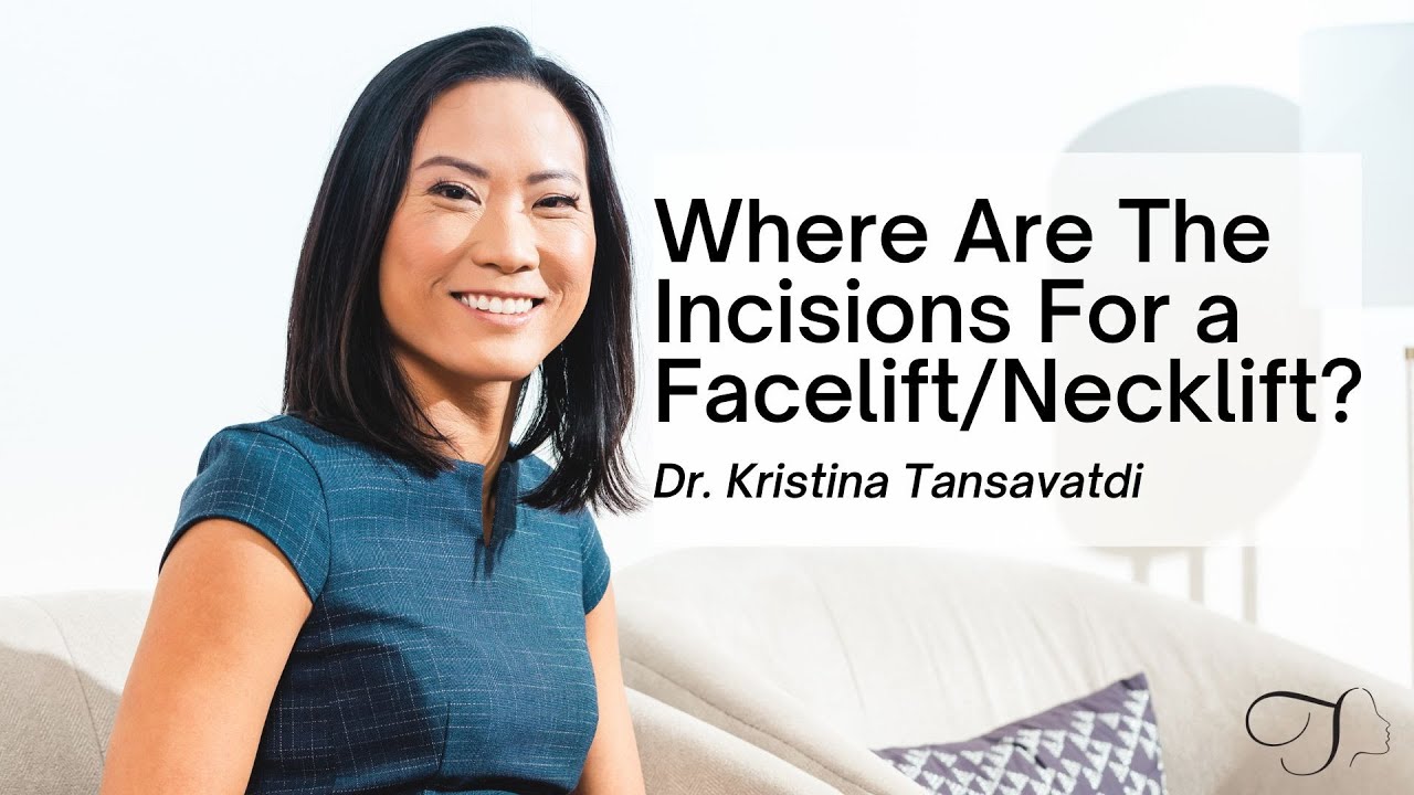 Where Are The Incisions For A Facelift/Necklift? | Dr. Kristina Tansavatdi