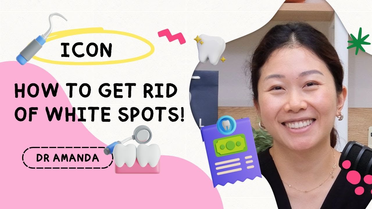 ICON Resin Infiltration: How To Get Rid of White Spots On Your Teeth!