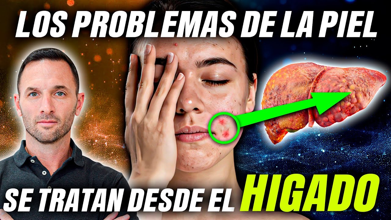 &iquest;PROBLEMAS DE PIEL? Descubre 3 CLAVES para una Piel SANA y RADIANTE