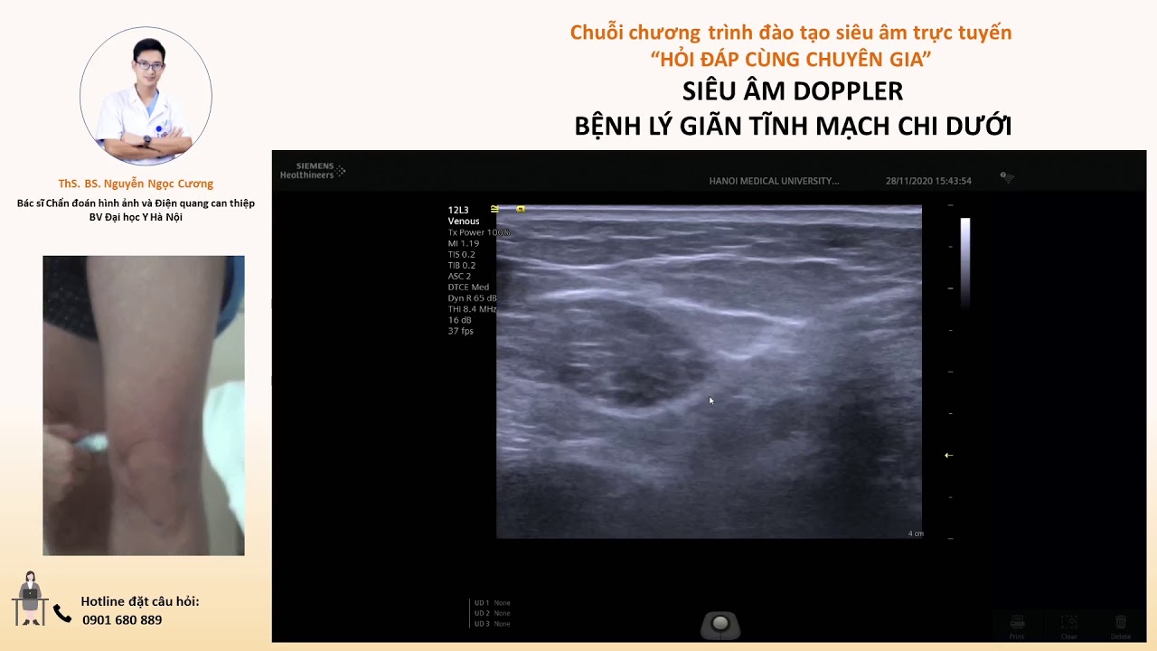 Thực hành siêu âm trên bệnh nhân suy tĩnh mạch nông