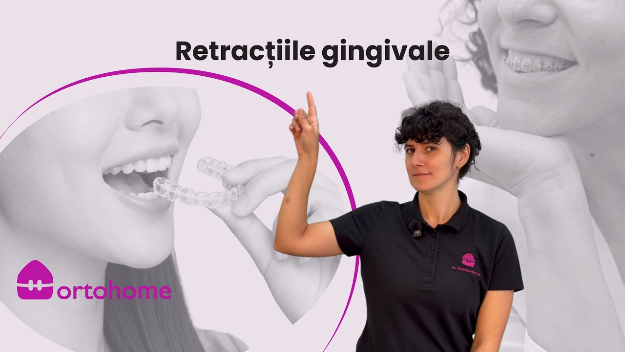 Retracțiile gingivale: cauze, simptome și tratament | De ce “se retrage” gingia și ce poți face