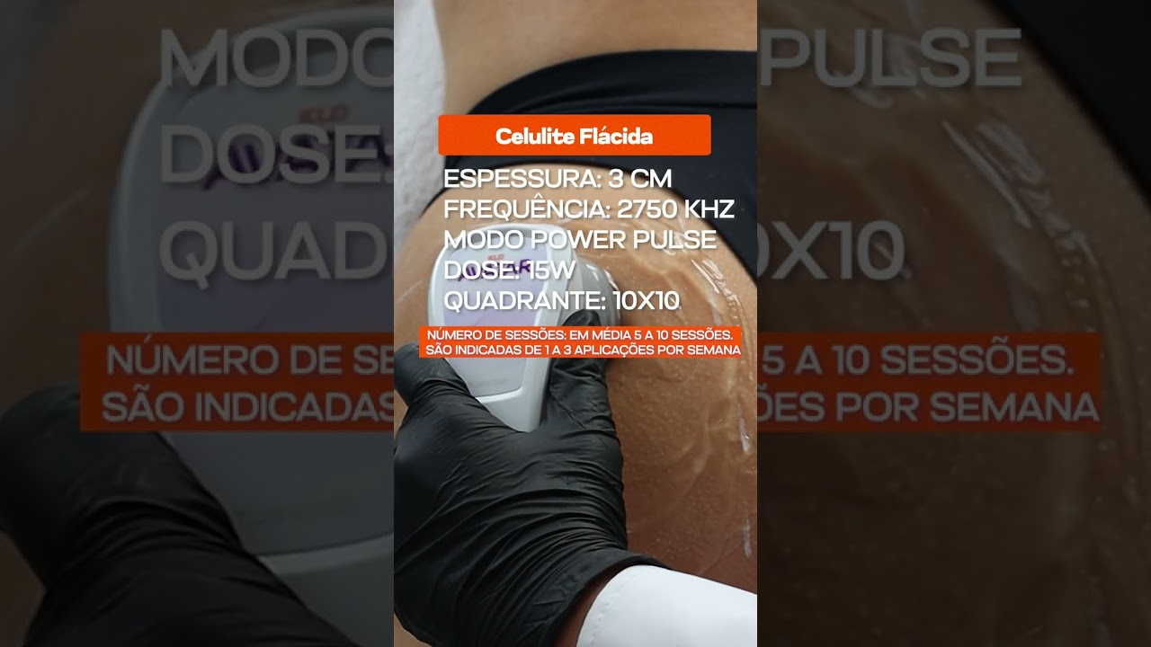 Protocolo de celulite - Ultracavita&ccedil;&atilde;o Avatar Esthetic