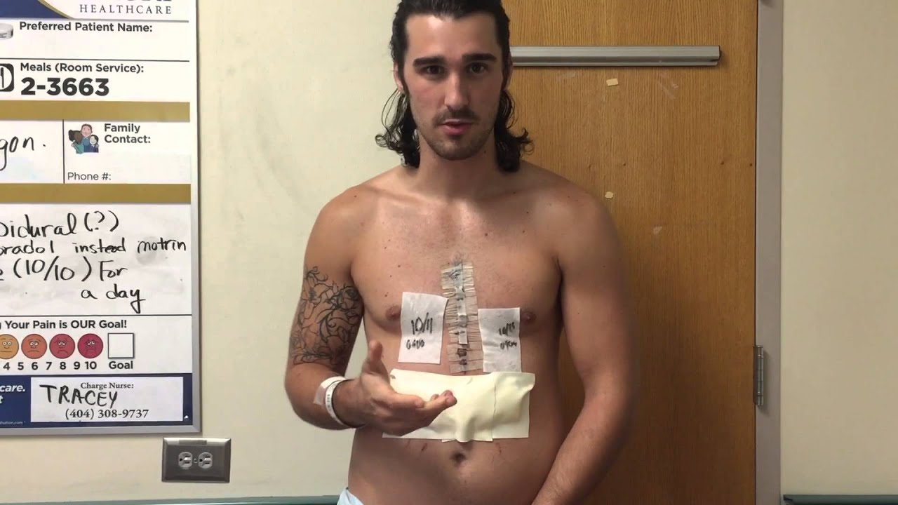 Pectus Excavatum Ravitch Procedure Day 5 pt2 leaving hospital