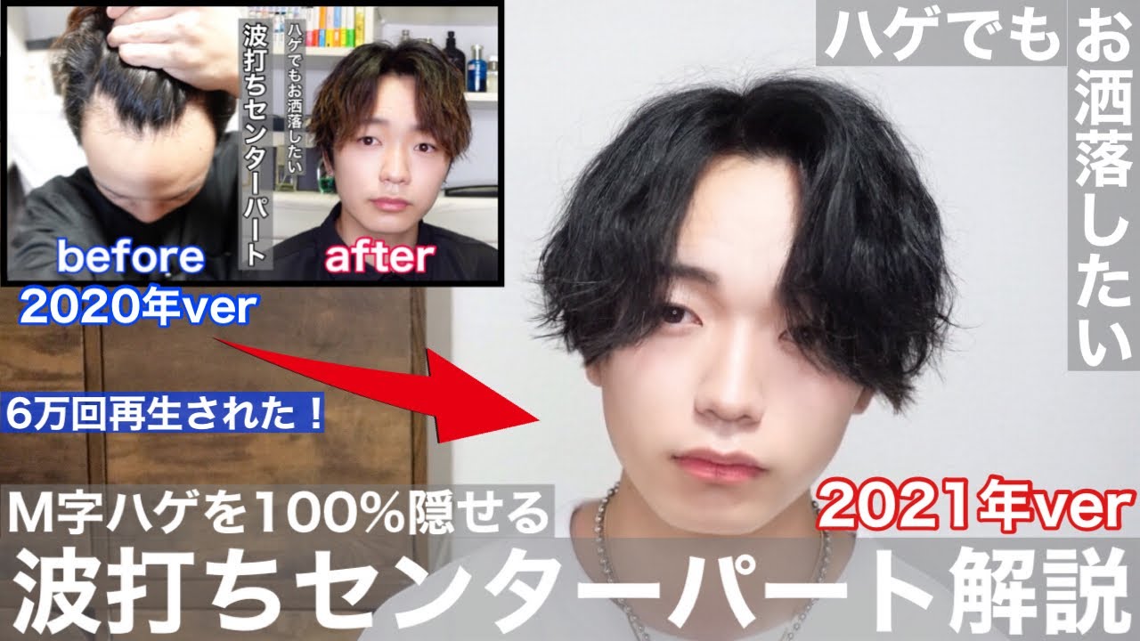 【徹底解説】M字ハゲを100%隠せる波打ちセンターパート2021年ver
