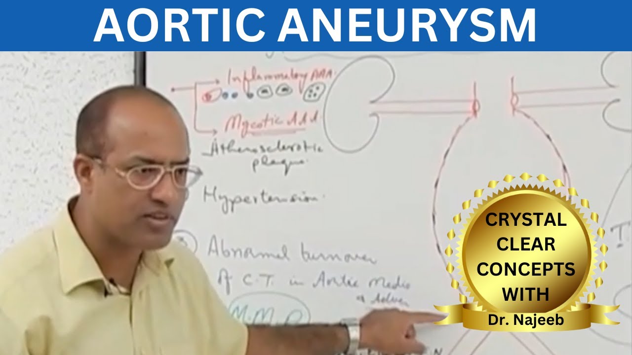 Aortic Aneurysm | Pathology |Diagnosis | Management 🫀