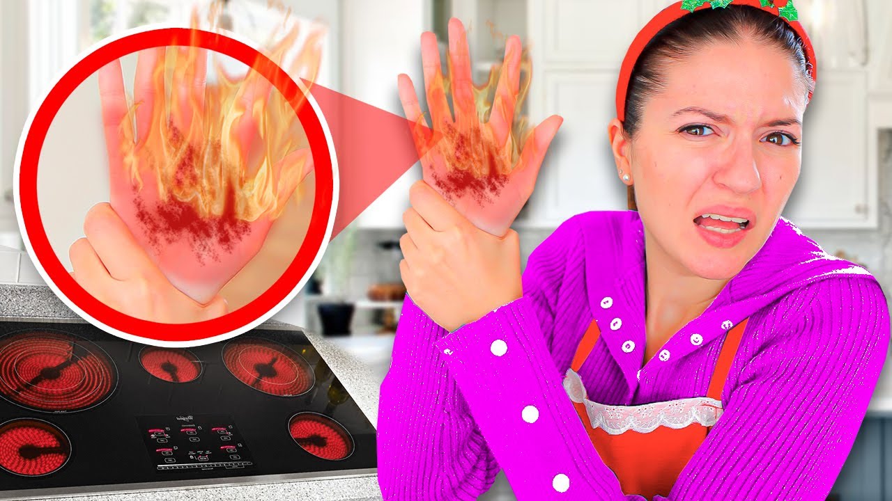 SOFÌ SI FA MALE E SI BRUCI ALLA MANO MENTRE CUCINA!!