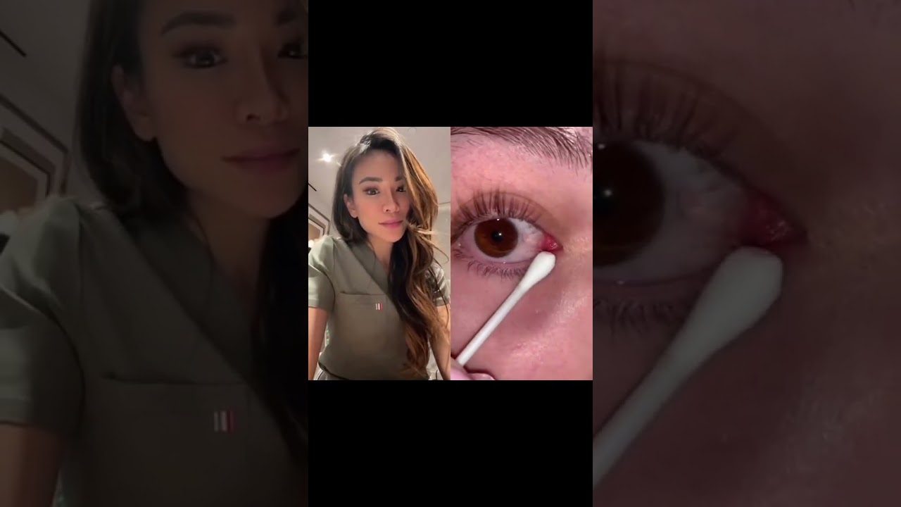 С вами такое случалось?? Это называется синдромом вылавливания слизи 🎣