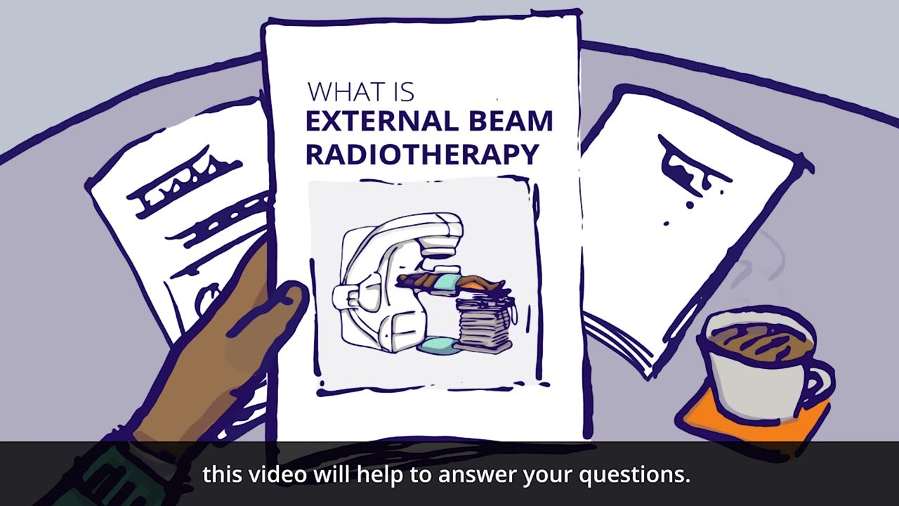 What is external beam radiotherapy (EBRT)?