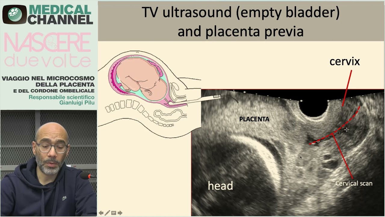 Viaggio nel microcosmo della placenta e del cordone ombelicale