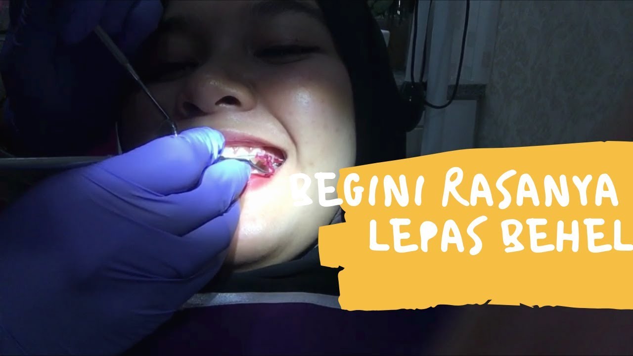 AKHIRNYA LEPAS BEHEL