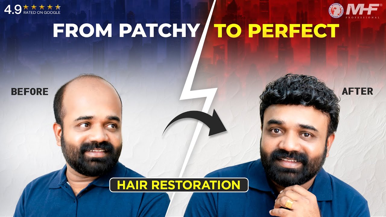 Most undetectable hair systems I Hair Fixing Solutions I  Zero Surgery