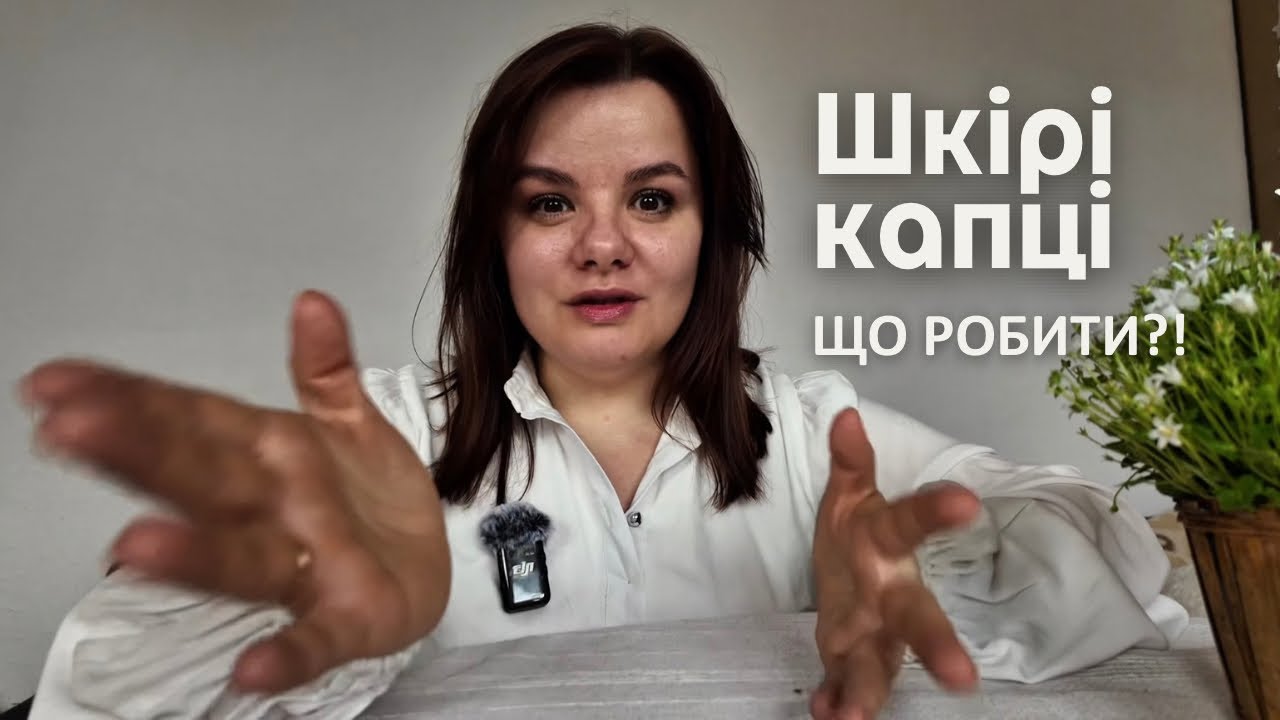 Себорейний дерматит і чутлива шкіра | Мій досвід догляду в Німеччині