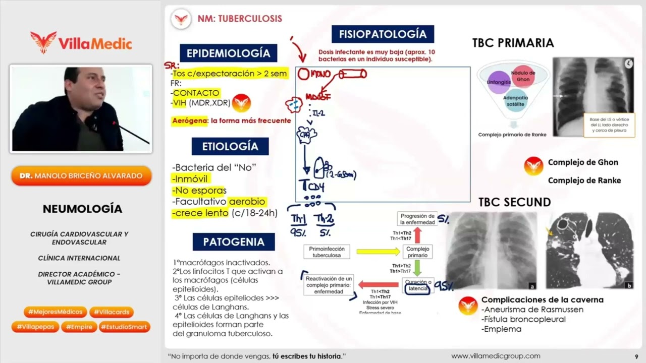 Tuberculosis VILLAMEDIC