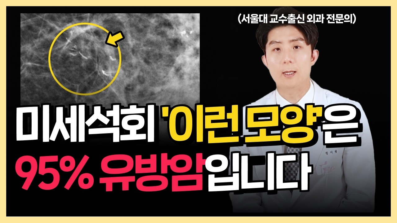 의사들도 잘 모르는 고위험 유방암 미세석회화 top 4