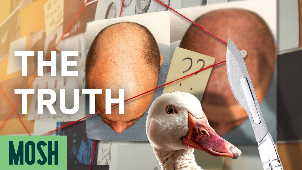 The TRUTH about Hair Transplants | Cures & Quackery EP#1 presented by Mosh
