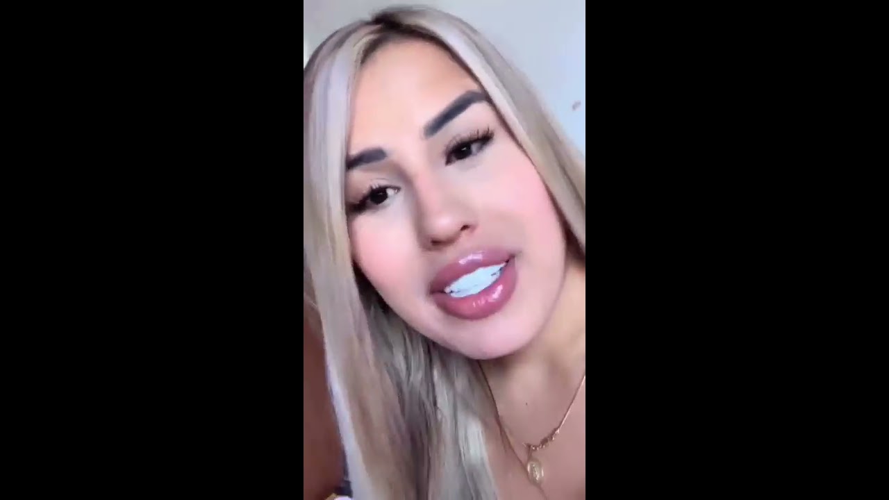 CAMILA GIL Complicación/deformidad en los senos y futuras cirugías