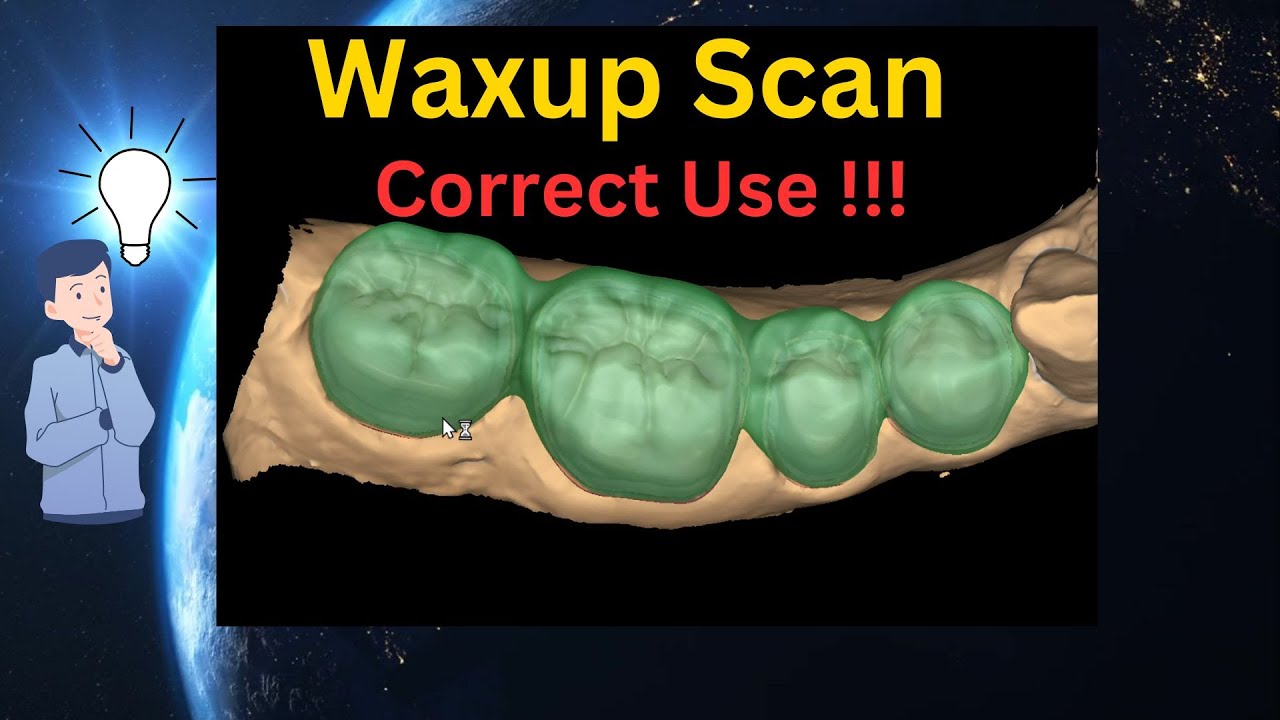 Correct use of WAXUP Scan (Exocad Tutorial)