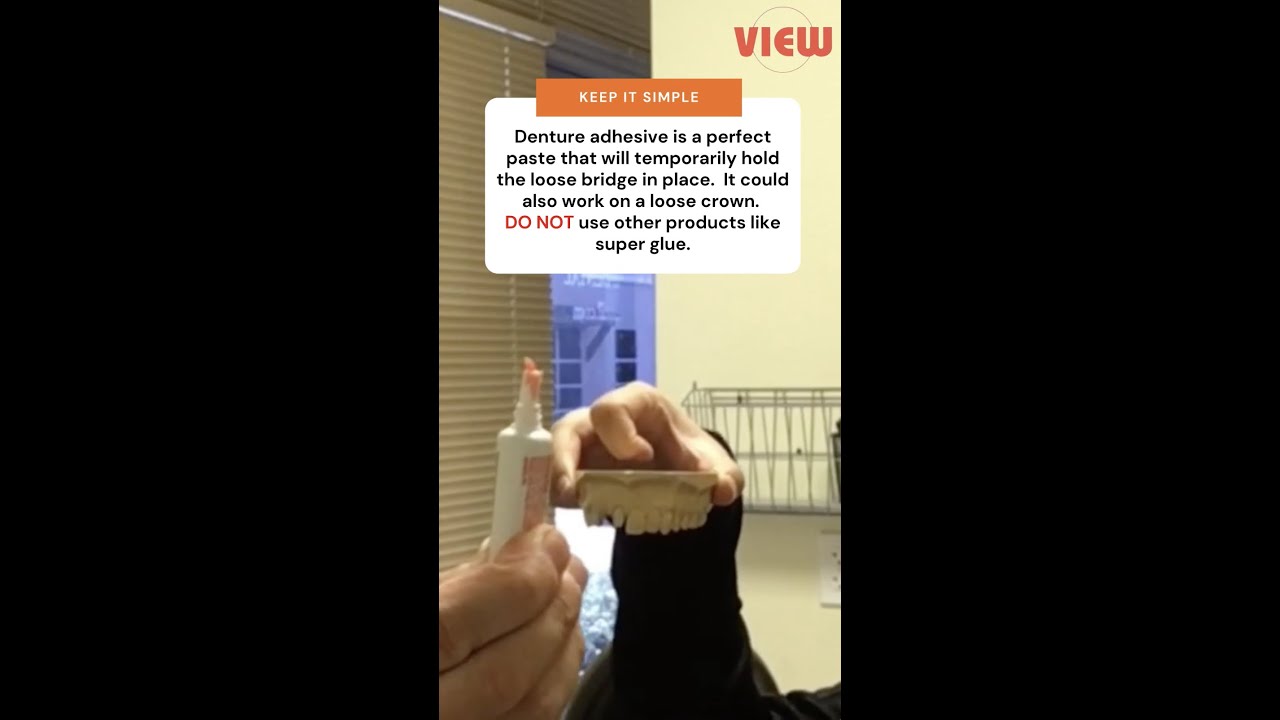 Temporarily Re-Cement a Loose Bridge with Denture Adhesive | View Mobile Dental