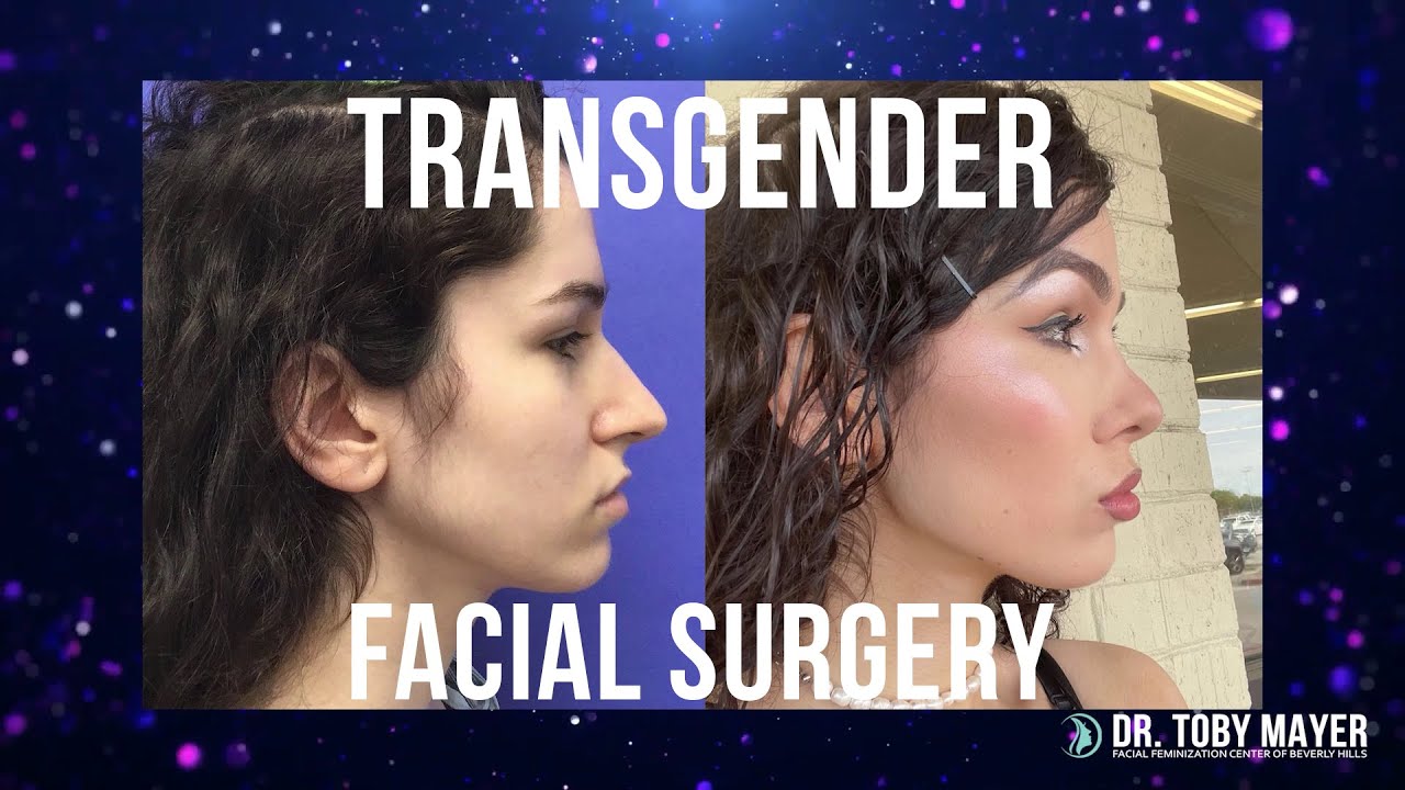 Dr. Toby Mayer - Changing Trans Lives Through Surgery