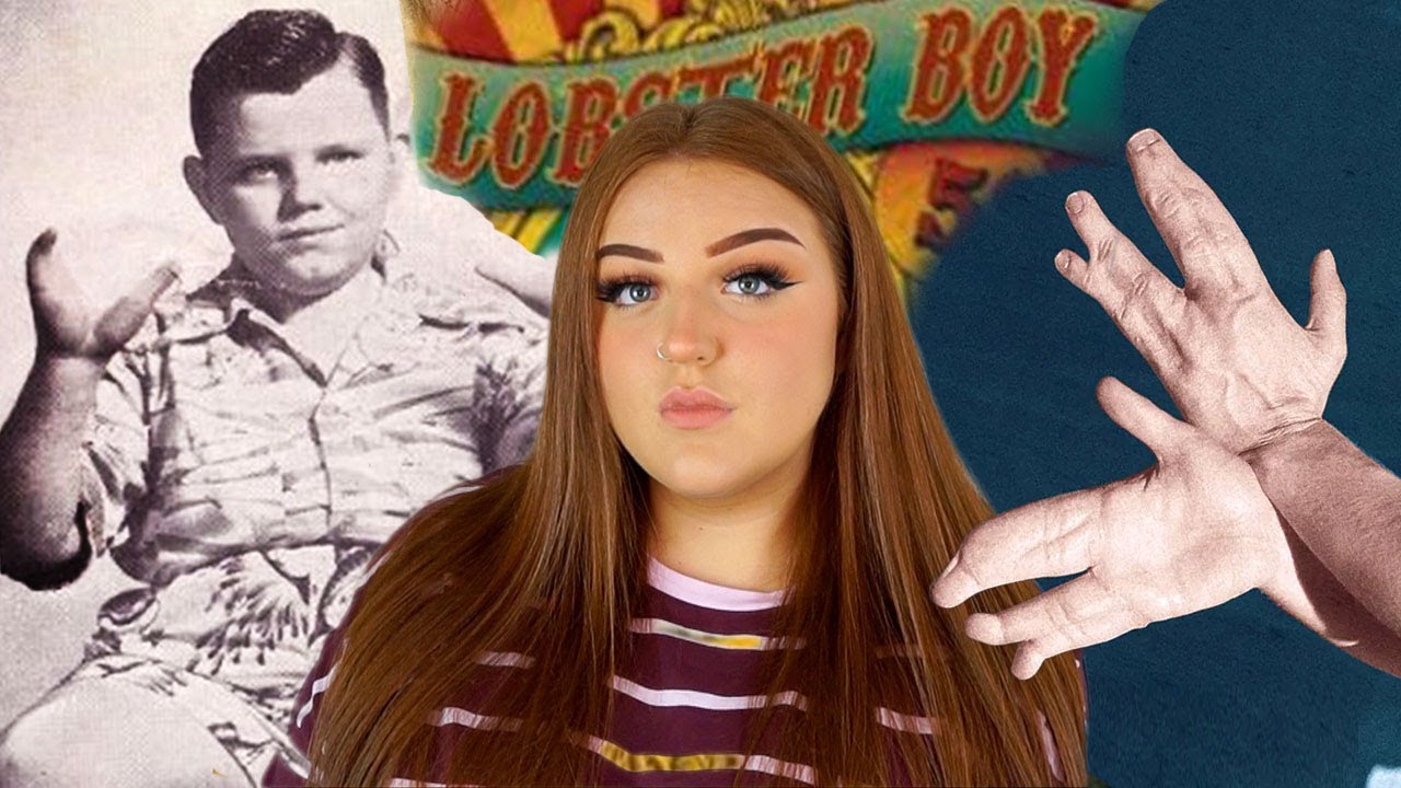 THE KILLER LOBSTER BOY