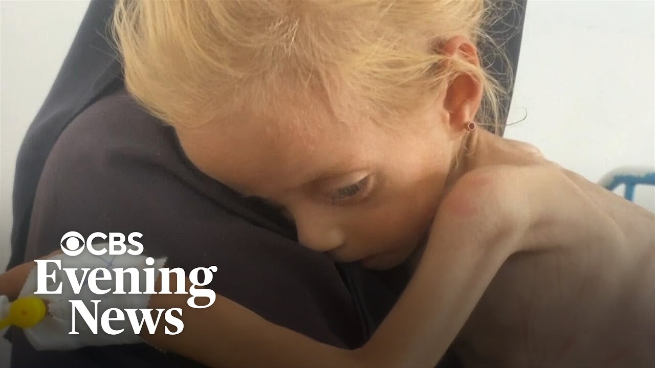 Netanyahu denies starvation in Gaza as images of emaciated children spark global outcry