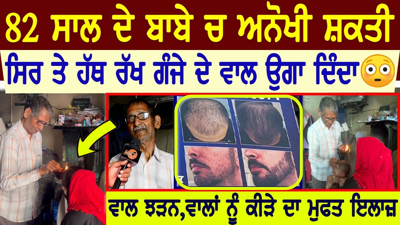 ਵੇਖੋ 82 ਸਾਲਾਂ ਬਾਬੇ ਚ ਅਨੋਖੀ ਸ਼ਕਤੀ😳ਸਿਰ ਤੇ ਹੱਥ ਰੱਖ ਗੰਜੇ ਦੇ ਵਾਲ ਉਗਾ ਦਿੰਦਾ,ਵਾਲ ਝੜਨ,ਵਾਲਾਂ ਕੀੜੇ ਦਾ ਫ੍ਰੀ ਇਲਾਜ਼