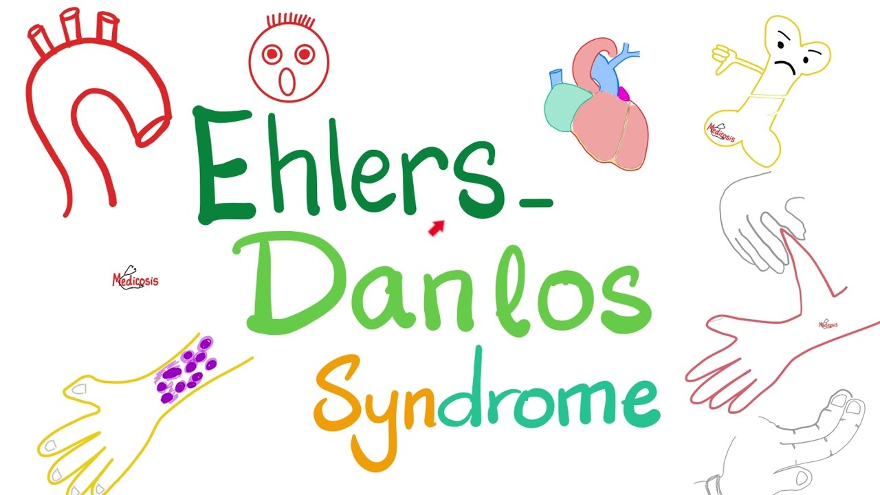 Ehlers-Danlos Syndrome - Causes, Symptoms, Diagnosis, and Treatment - Biochemistry & Genetics