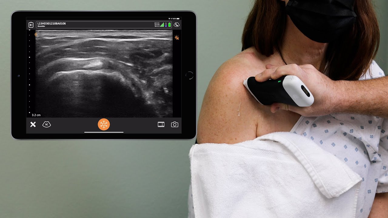 Ultrasound of the Shoulder