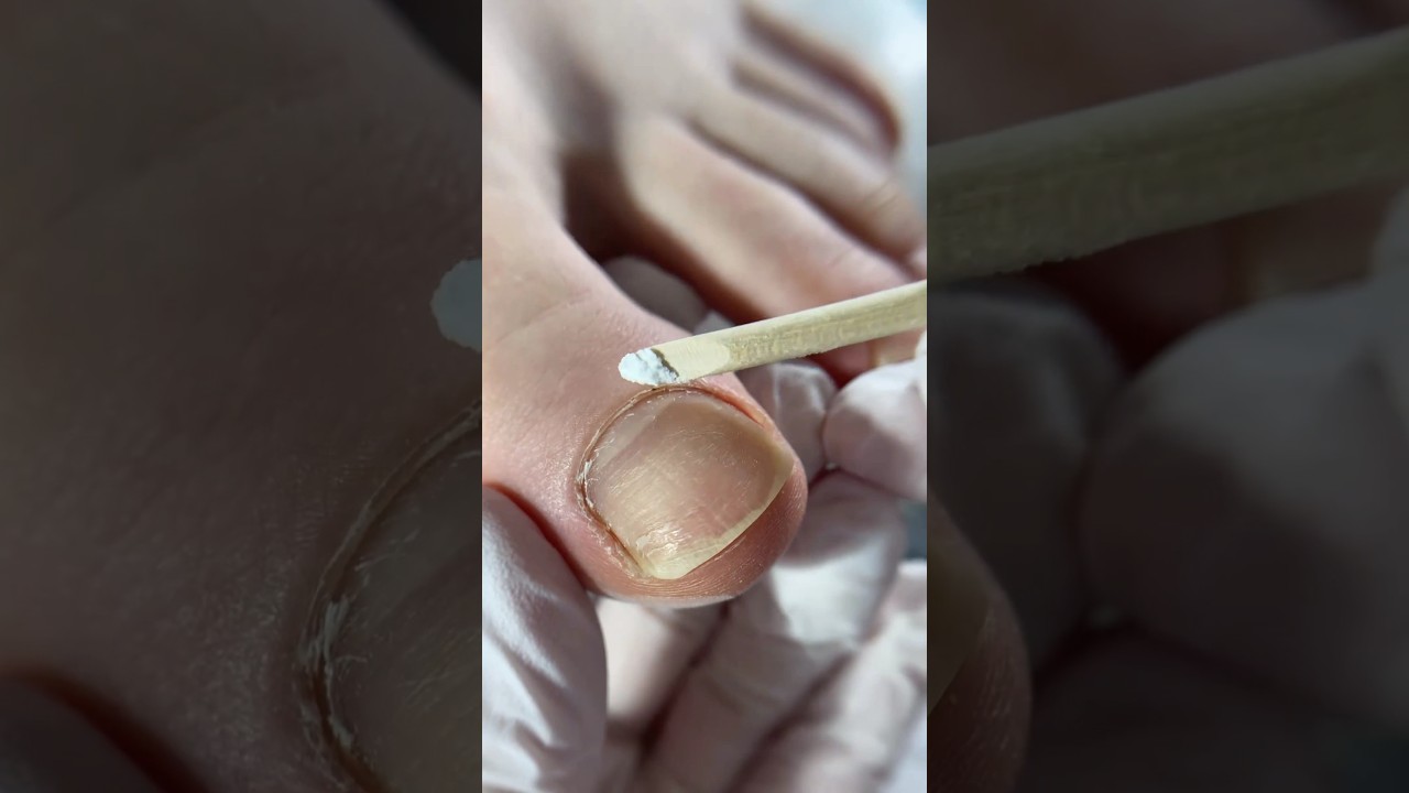 feet nail care dry Pedicure #trending #viral #hack #nailtutorial #nailart #diy #feet #shorts #short