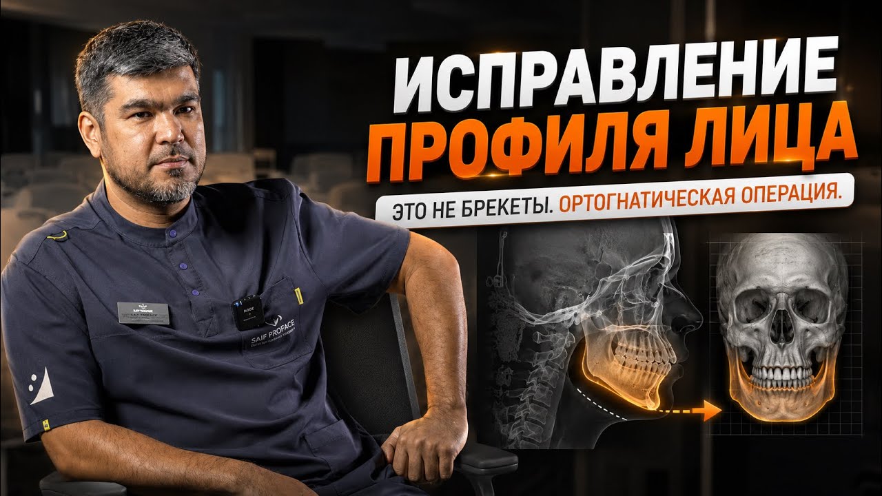 Неправильный прикус и асимметрия лица: операция или брекеты?